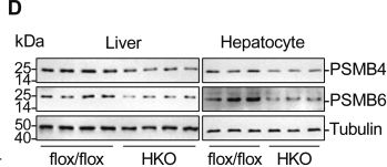 Fig.5.D showing Western Blotting from the publication: Hepatocyte-specific Wtap deficiency promotes hepatocellular carcinoma by activating GRB2-ERK depending on downregulation of proteasome-related genes.