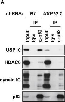 USP10 Is a Driver of Ubiquitinated Protein Aggregation and Aggresome Formation to Inhibit Apoptosis.