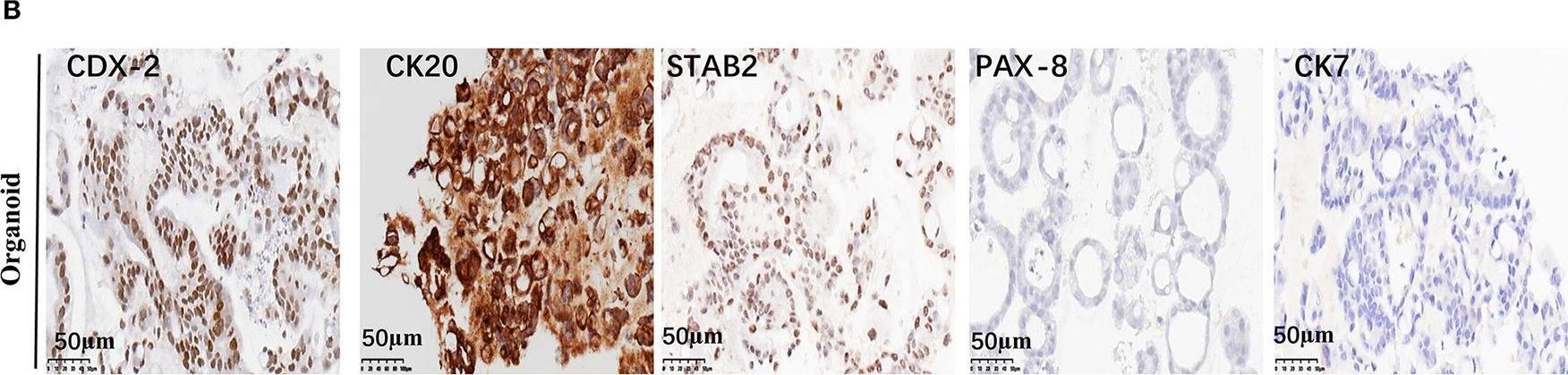 Fig.3.B showing Immunohistochemistry from the publication: Organoids From Mucinous Appendiceal Adenocarcinomas as High-Fidelity Models for Individual Therapy.