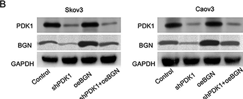Fig.4.B showing Western Blotting from the publication: PDK1 promotes epithelial ovarian cancer progression by upregulating BGN.