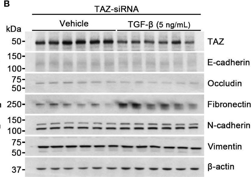 Fig.3.B showing Western Blotting in a Homo sapiens (Human) sample from the publication: TAZ is involved in breast cancer cell migration via regulating actin dynamics.