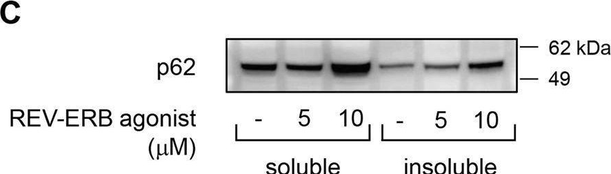 The nuclear receptor REV-ERBα is implicated in the alteration of β-cell autophagy and survival under diabetogenic conditions.
