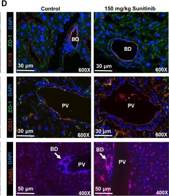 Fig.2.D showing Immunohistochemistry-immunofluorescence in a Mus musculus (House mouse) sample from the publication: Gut microbiota depletion and FXR inhibition exacerbates zonal hepatotoxicity of sunitinib.
