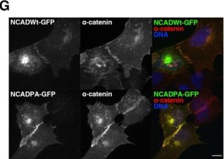 Fig.6.G showing Immunocytochemistry-immunofluorescence in a Homo sapiens (Human) sample from the publication: Pacsin 2-dependent N-cadherin internalization regulates the migration behaviour of malignant cancer cells.