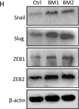Fig.3.H showing Western Blotting from the publication: Cancer stem cell property and gene signature in bone-metastatic Breast Cancer cells.
