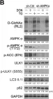 Fig.5.B showing Western Blotting in a Homo sapiens (Human) sample from the publication: Blockage of O-linked GlcNAcylation induces AMPK-dependent autophagy in bladder cancer cells.