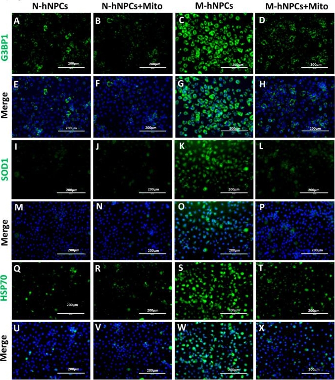 Fig.7.V showing Immunocytochemistry-immunofluorescence from the publication: Targeting TDP-43 Proteinopathy in hiPSC-Derived Mutated hNPCs with Mitoxantrone Drugs and miRNAs.