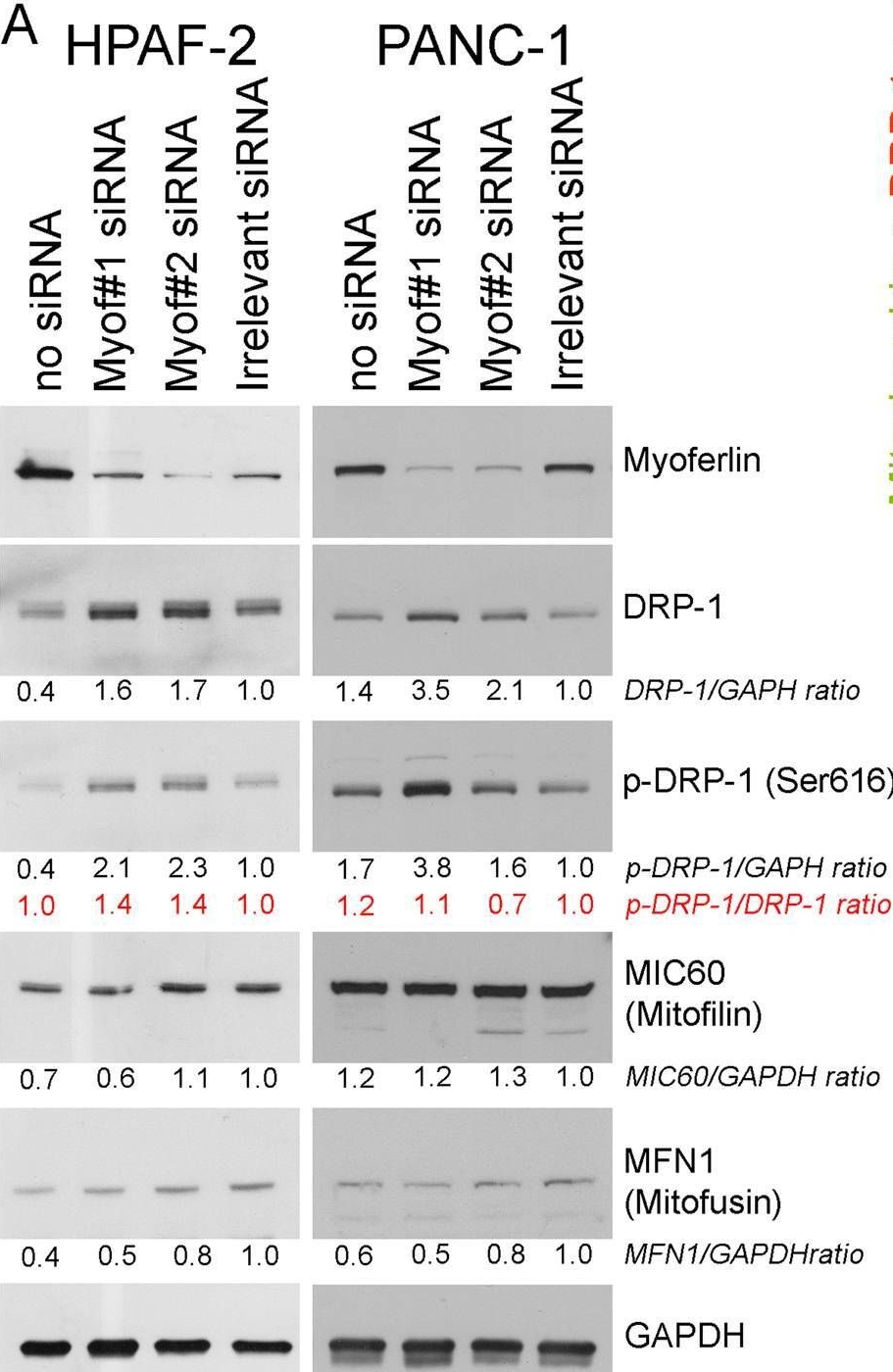 Fig.6.A showing Western Blotting in a Homo sapiens (Human) sample from the publication: Myoferlin controls mitochondrial structure and activity in pancreatic ductal adenocarcinoma, and affects tumor aggressiveness.