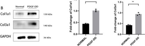 COL1A1 Antibody (E8I9Z) | Cell Signaling Technology