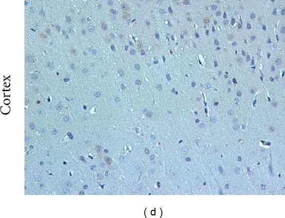 Fig.5.D showing Immunohistochemistry in a Rattus norvegicus (Rat) sample from the publication: Guizhi-Fuling-Wan, a Traditional Chinese Herbal Medicine, Ameliorates Memory Deficits and Neuronal Apoptosis in the Streptozotocin-Induced Hyperglycemic Rodents via the Decrease of Bax/Bcl2 Ratio and Caspase-3 Expression.