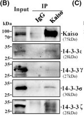 Fig.4.B showing Western Blotting in a Homo sapiens (Human) sample from the publication: Kaiso phosphorylation at threonine 606 leads to its accumulation in the cytoplasm, reducing its transcriptional repression of the tumour suppressor CDH1.