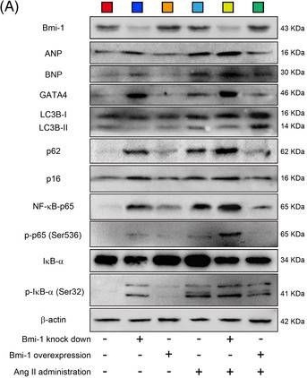 Recombinant Anti-NF-kB p65 (phospho S536) antibody [EP2294Y] (ab76302)