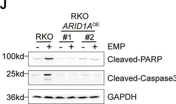 Fig.2.J showing Western Blotting from the publication: MAP4 phosphorylation induced by ARID1A loss sensitizes colorectal cancer cells to EMP.