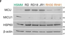 Fig.1.F showing Western Blotting from the publication: Mitochondrial calcium uptake regulates tumour progression in embryonal rhabdomyosarcoma.