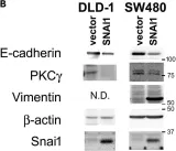 Fig.1.B showing Western Blotting in a Homo sapiens (Human) sample from the publication: Downregulation of protein kinase C gamma reduces epithelial property and enhances malignant phenotypes in colorectal cancer cells.