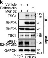 Fig.2.K showing Western Blotting in a Homo sapiens (Human) sample from the publication: CDK4/6 inhibitors dephosphorylate RNF26 to stabilize TSC1 and increase the sensitivity of ccRCC to mTOR inhibitors.
