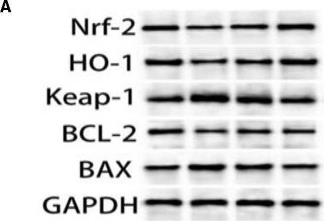 Fig.3.A showing Western Blotting from the publication: Exploration of the protective mechanisms of Icariin against cisplatin-induced renal cell damage in canines.