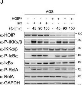 Fig.6.J showing Western Blotting from the publication: CYLD-TRAF6 interaction promotes ADP-heptose-induced NF-κB signaling in H. pylori infection.