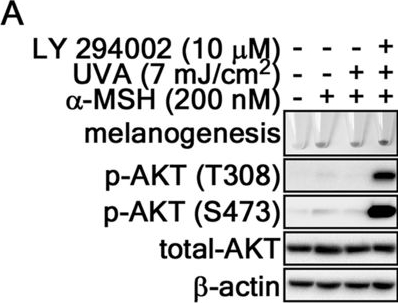 Fig.2.A showing Western Blotting in a Mus musculus (House mouse) sample from the publication: Ribosomal S6 kinase 2-forkhead box protein O4 signaling pathway plays an essential role in melanogenesis.