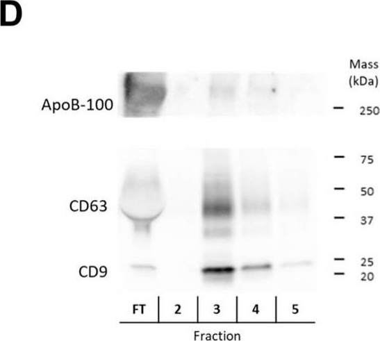 Fig.2.D showing Western Blotting in a Homo sapiens (Human) sample from the publication: Inline Raman Spectroscopy Provides Versatile Molecular Monitoring for Platelet Extracellular Vesicle Purification with Anion-Exchange Chromatography.