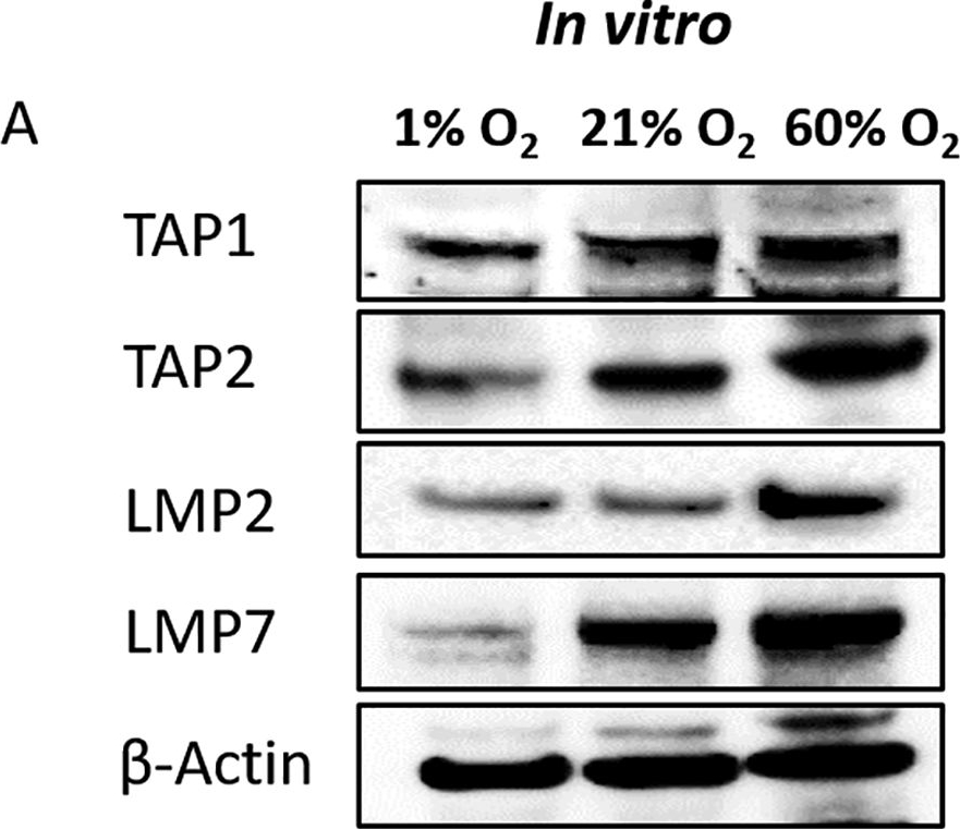 Fig.7.A showing Western Blotting in a Homo sapiens (Human) sample from the publication: Hypoxia and hypoxia-inducible factor (HIF) downregulate antigen-presenting MHC class I molecules limiting tumor cell recognition by T cells.