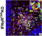 Fig.7.M showing Immunocytochemistry-immunofluorescence in a Mus musculus (House mouse) sample from the publication: IFN-gamma signaling in the central nervous system controls the course of experimental autoimmune encephalomyelitis independently of the localization and composition of inflammatory foci.