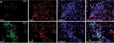 Fig.1.B showing Immunofluorescence in a Mus musculus (House mouse) sample from the publication: Neuronal IFN-beta-induced PI3K/Akt-FoxA1 signalling is essential for generation of FoxA1+Treg cells.