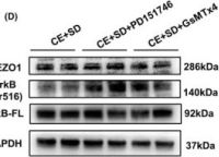 Phospho-TrkA (Tyr490)/TrkB (Tyr516) (C35G9) Rabbit mAb