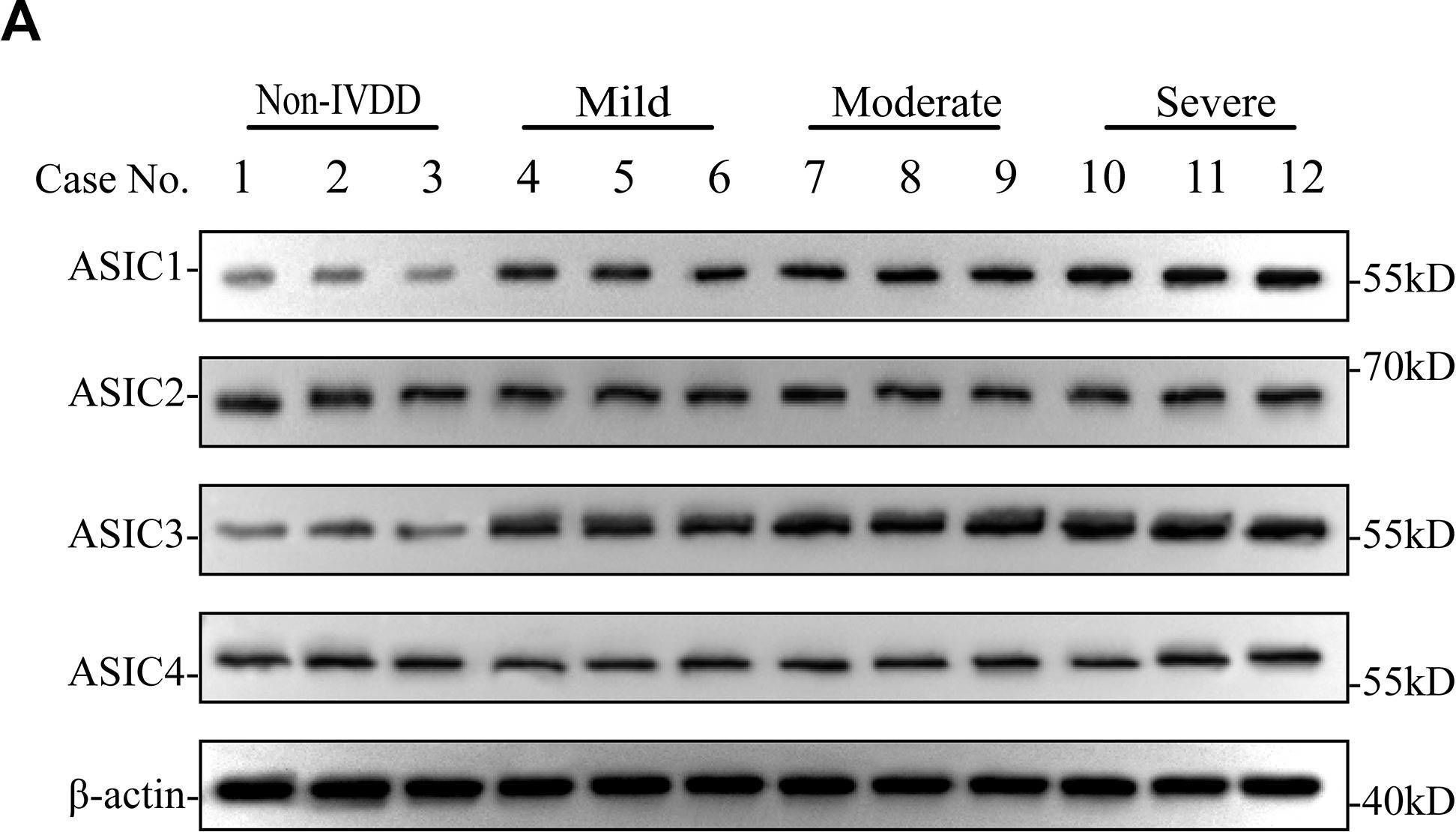 asic2 antibodies - Antibody search engine - CiteAb
