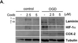 Fig.4.A showing Western Blotting from the publication: Inflammation modulates expression of laminin in the central nervous system following ischemic injury.