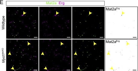 Fig.3.E showing Immunocytochemistry-immunofluorescence from the publication: MYCT1-IFITM2/3 interaction links endothelial endolysosomal trafficking to white adipose tissue expansion.