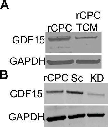 Fig.4.A showing Western Blotting from the publication: Transplanted allogeneic cardiac progenitor cells secrete GDF-15 and stimulate an active immune remodeling process in the ischemic myocardium.