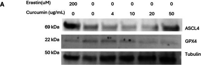 Fig.4.A showing Western Blotting in a Homo sapiens (Human) sample from the publication: Low, plasma level‑informed native curcumin concentrations fail to induce cell death in human lung and colorectal cancer cells.