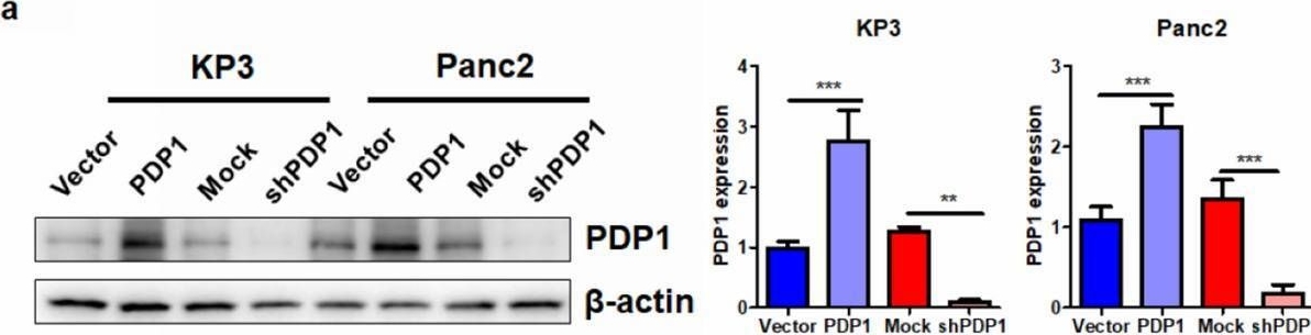 Fig.2.A showing Western Blotting in a Mus musculus (House mouse) sample from the publication: Overexpression of pyruvate dehydrogenase phosphatase 1 promotes the progression of pancreatic adenocarcinoma by regulating energy-related AMPK/mTOR signaling.