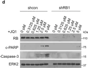 Fig.1.D showing Western Blotting from the publication: Retinoblastoma protein as an intrinsic BRD4 inhibitor modulates small molecule BET inhibitor sensitivity in cancer.