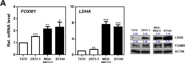 Fig.4.A showing Western Blotting in a Homo sapiens (Human) sample from the publication: Genomic Signature of the Standardized Uptake Value in 18F-Fluorodeoxyglucose Positron Emission Tomography in Breast Cancer.