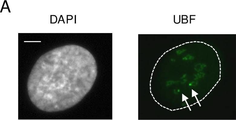 Fig.8.A showing Immunocytochemistry-immunofluorescence in a Homo sapiens (Human) sample from the publication: JMJD6 participates in the maintenance of ribosomal DNA integrity in response to DNA damage.