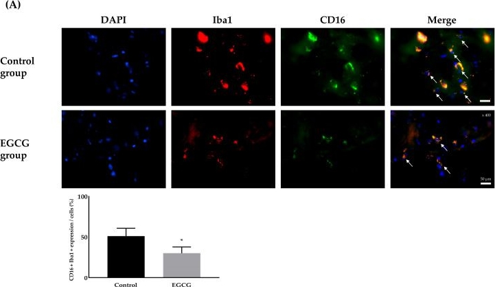 Fig.4.A showing Immunocytochemistry-immunofluorescence in a Rattus norvegicus (Rat) sample from the publication: Preventive Effect of Epigallocatechin-3-Gallate on Postoperative Cognitive Dysfunction in Aged Rats via Modulation of Microglial Differentiation: An Experimental Animal Study.