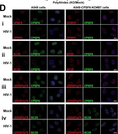 Fig.5.D showing Immunocytochemistry-immunofluorescence from the publication: HIV-1 infection regulates gene expression by altering alternative polyadenylation correlated with CPSF6 and CPSF5 redistribution.
