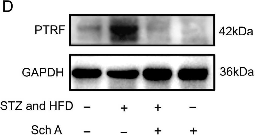 Fig.7.D showing Western Blotting from the publication: Schisandrin A Attenuates Diabetic Nephropathy via EGFR/AKT/GSK3β Signaling Pathway Based on Network Pharmacology and Experimental Validation.