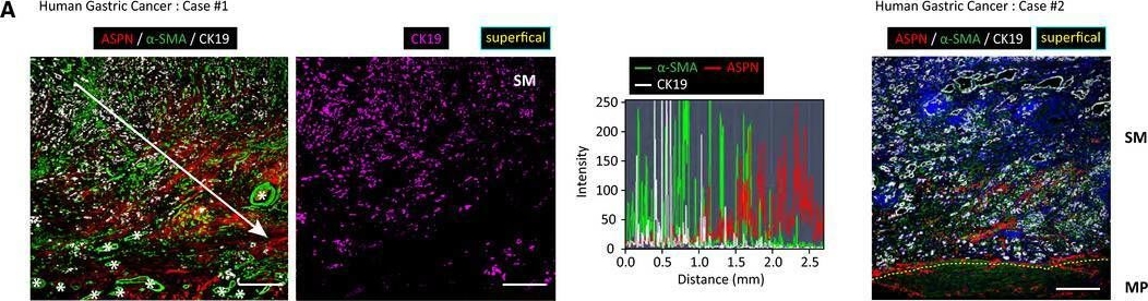 Fig.5.A showing Immunohistochemistry-immunofluorescence in a Mus musculus (House mouse) sample from the publication: Cancer-associated fibroblasts educate normal fibroblasts to facilitate cancer cell spreading and T-cell suppression.