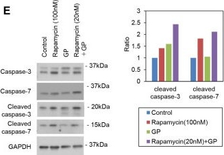 Fig.1.E showing Western Blotting from the publication: Inhibitory effects of the combination of rapamycin with gemcitabine plus paclitaxel on the growth of pancreatic cancer tumors.