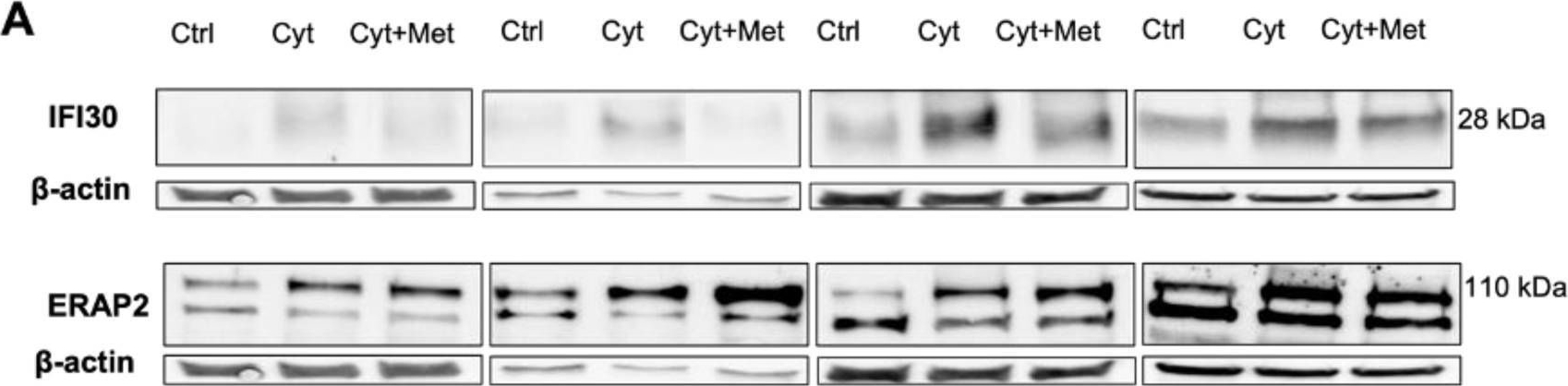 Fig.6.A showing Western Blotting from the publication: The Protective Action of Metformin against Pro-Inflammatory Cytokine-Induced Human Islet Cell Damage and the Mechanisms Involved.