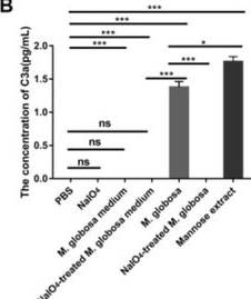 Fig.5.B showing Enzyme-linked immunosorbent assay from the publication: Fungal Colonization by Malassezia globosa Promotes Breast Cancer Progression and M2 Macrophage Polarization Through the MBL-C3a-C3aR Signaling Pathway.