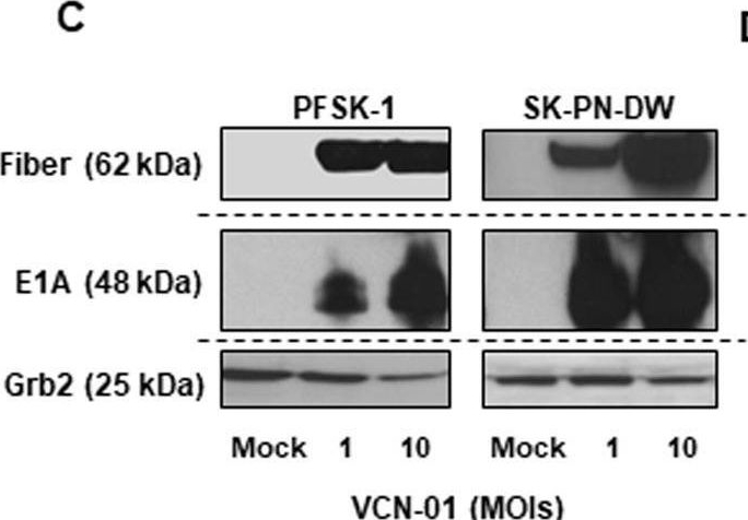 Fig.1.C showing Western Blotting in a Homo sapiens (Human) sample from the publication: The oncolytic adenovirus VCN-01 promotes anti-tumor effect in primitive neuroectodermal tumor models.