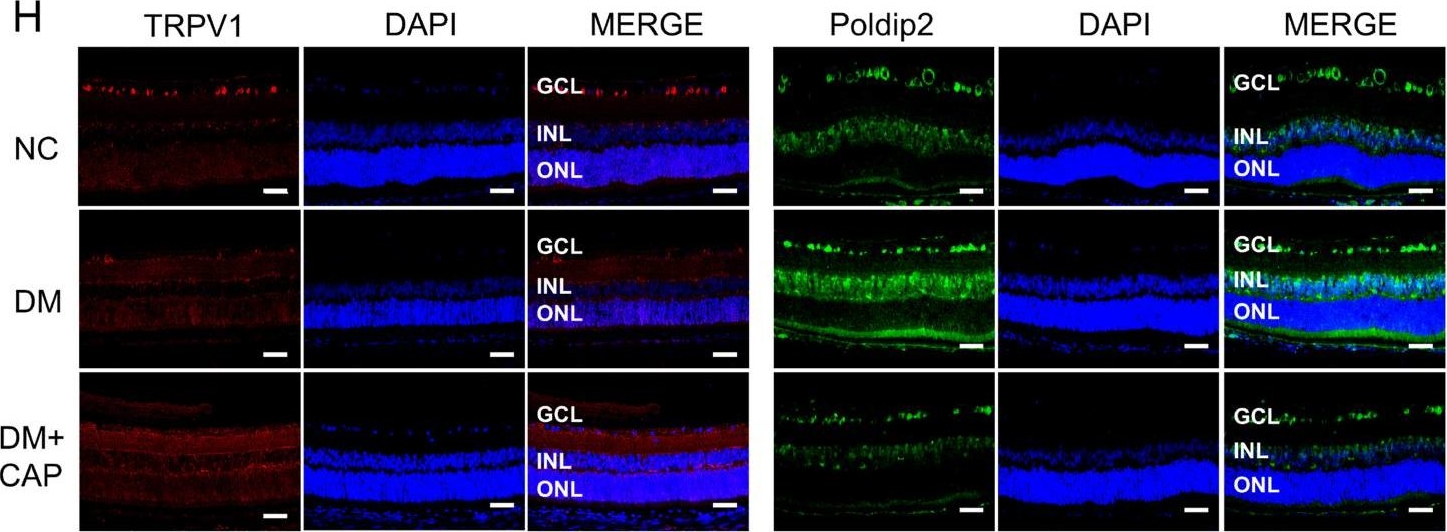 Fig.3.H showing Immunohistochemistry-immunofluorescence from the publication: Capsaicin ameliorates diabetic retinopathy by inhibiting poldip2-induced oxidative stress.
