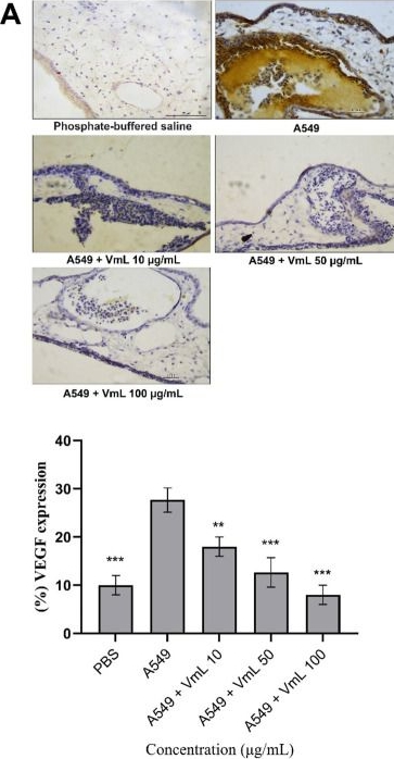 Fig.4.A showing Immunohistochemistry in a Gallus gallus domesticus (Chicken) sample from the publication: Lectin from Vatairea macrocarpa (Benth.) Ducke Exhibits Selective Cytotoxicity and Angiogenesis Inhibition in Lung Cancer Cells.