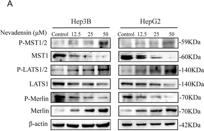 Fig.4.A showing Western Blotting in a Homo sapiens (Human) sample from the publication: Activating the Hippo pathway by nevadensin overcomes Yap-drived resistance to sorafenib in hepatocellular carcinoma.