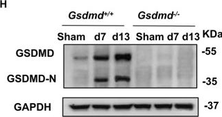 Fig.1.H showing Western Blotting in a Mus musculus (House mouse) sample from the publication: GSDMD-dependent neutrophil extracellular traps promote macrophage-to-myofibroblast transition and renal fibrosis in obstructive nephropathy.