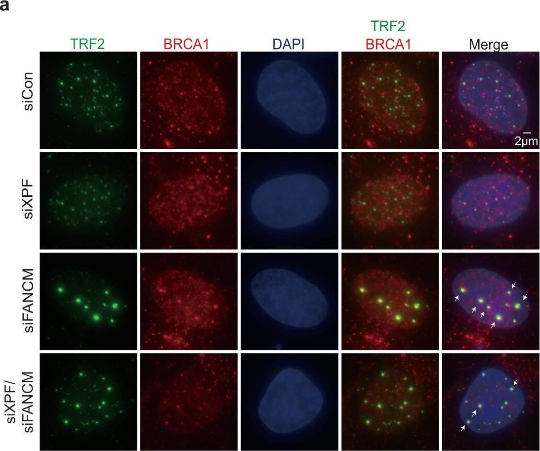 Fig.6.A showing Immunocytochemistry-immunofluorescence in a Homo sapiens (Human) sample from the publication: XPF activates break-induced telomere synthesis.